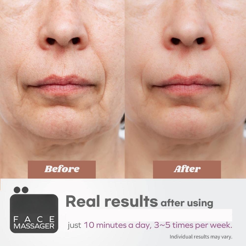 Facial Massager Device: image 4